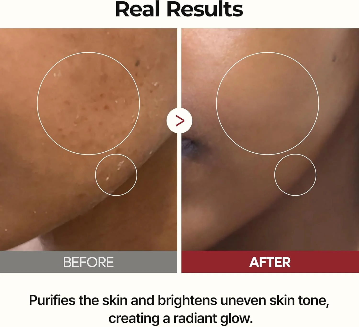 Peel Shot Glow Rice Ampoule Duo - Image 3