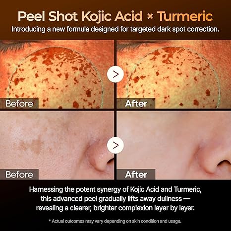 Peel Shot Glow Rice Ampoule Duo - Image 4