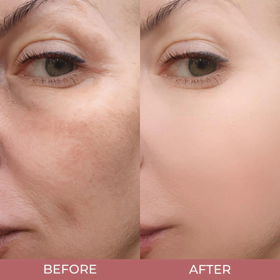 Peel Shot Glow Rice Ampoule Duo - Image 8