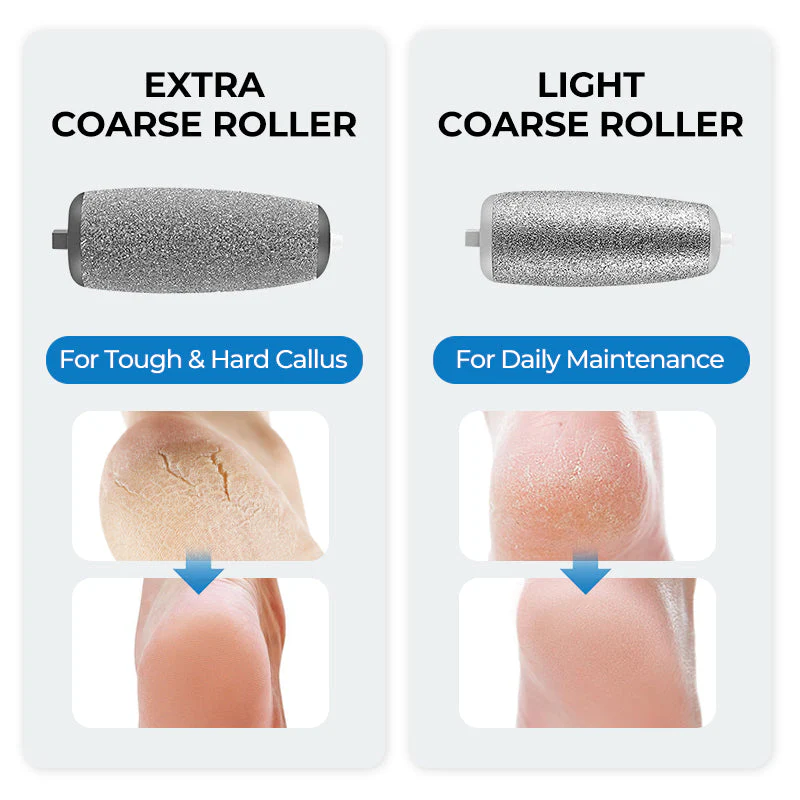 🔥Electric Feet Callus Remover⚡ - Image 5