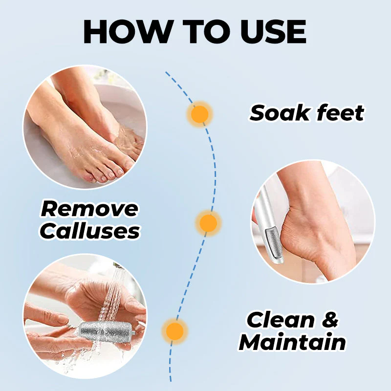 🔥Electric Feet Callus Remover⚡ - Image 8