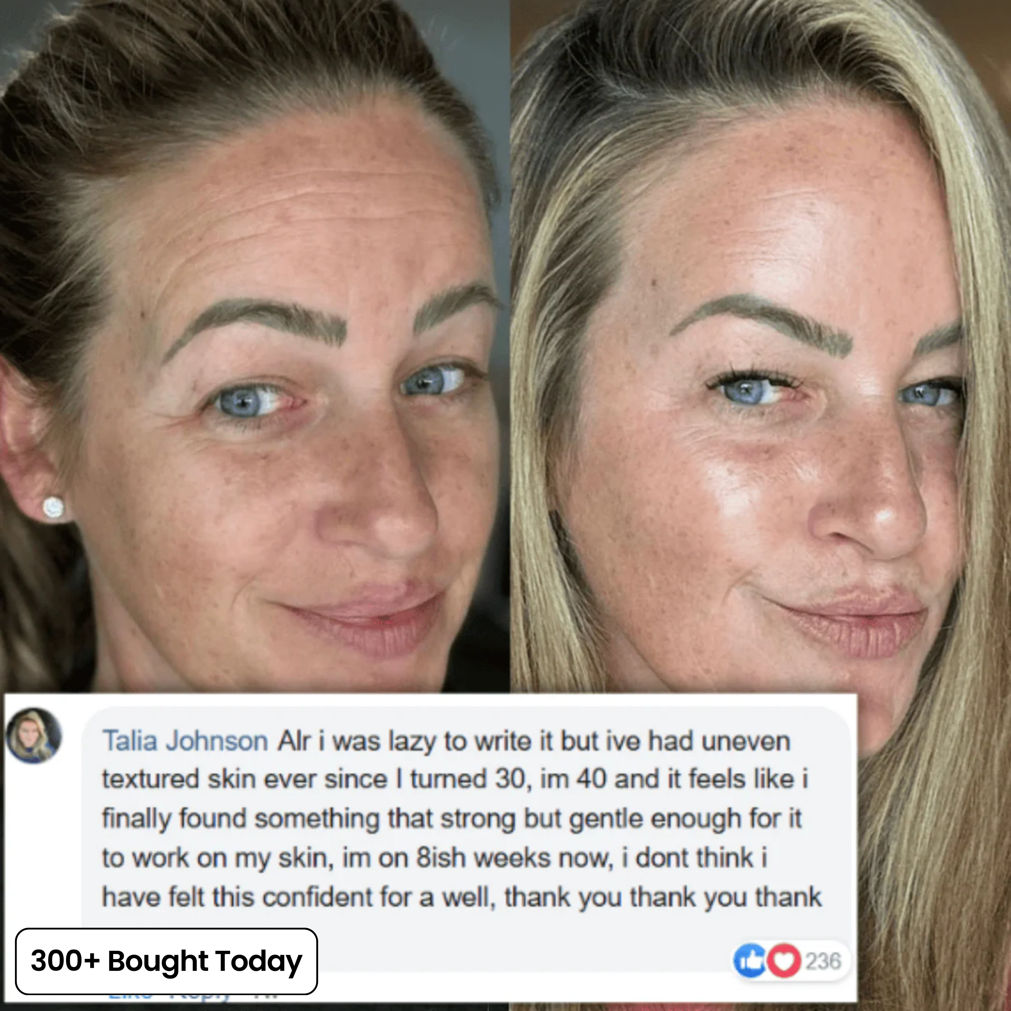 Transform Wrinkles, Fine Lines, And Tired Creases Naturally - Image 7