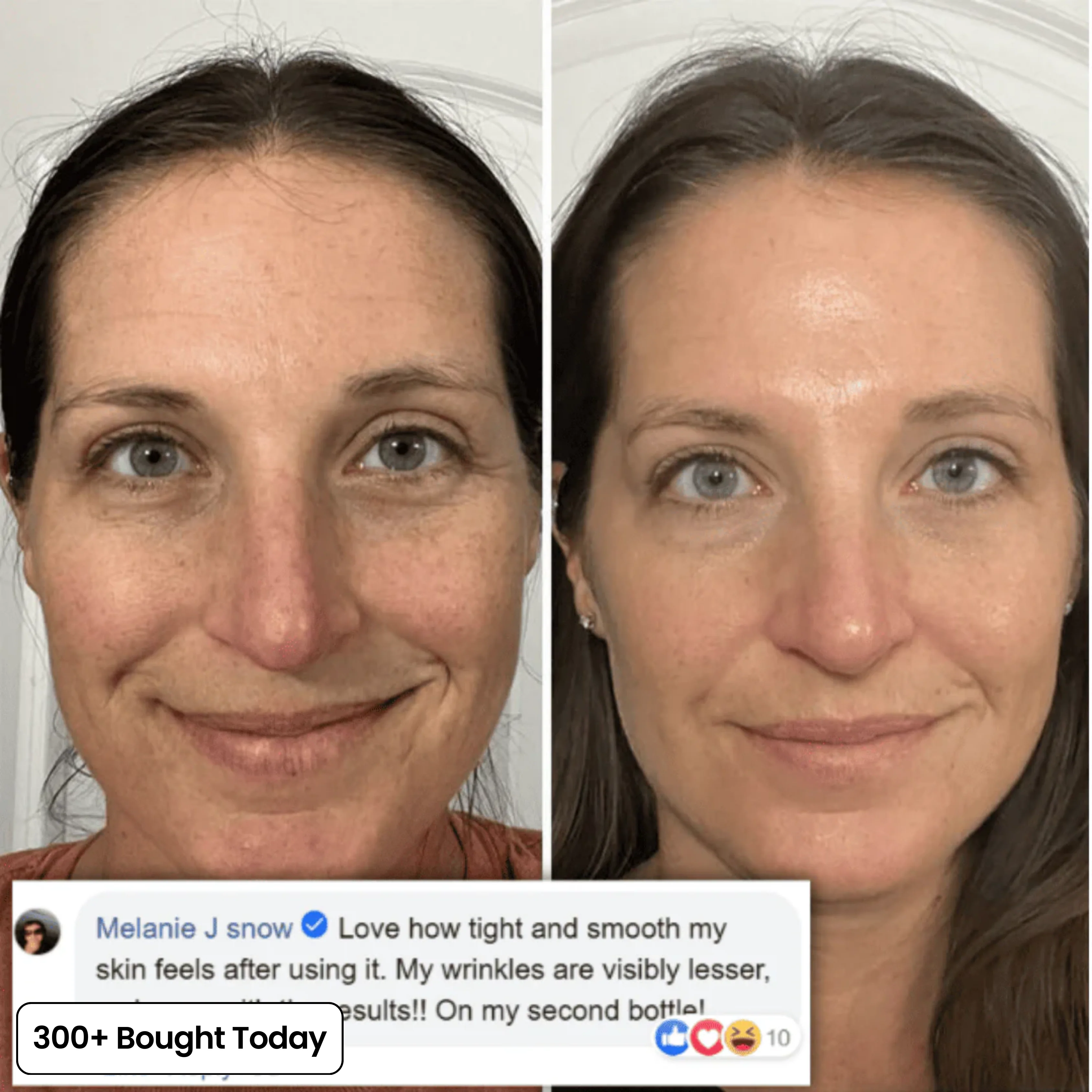 Transform Wrinkles, Fine Lines, And Tired Creases Naturally - Image 8