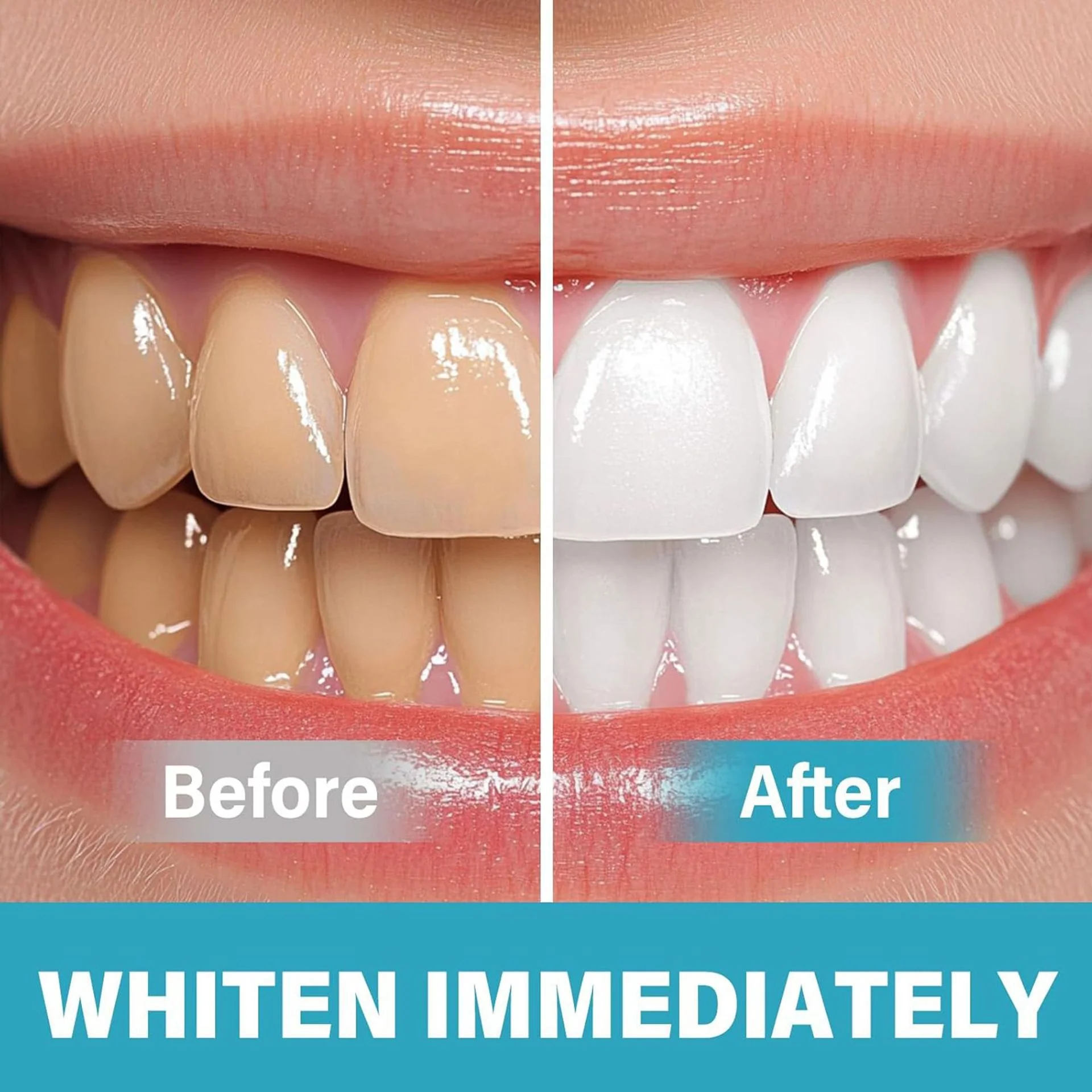 Instant Teeth Whitening Paint - Image 5