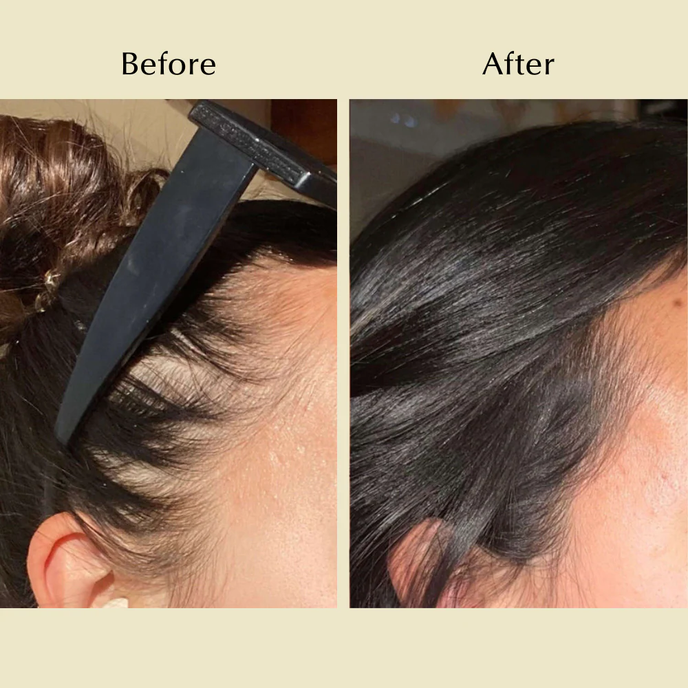 Natural Hair Growth Oil - Image 3