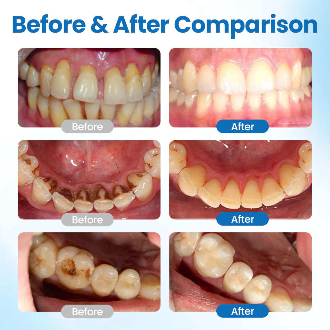 Tiktrove™ NanoHAP Tooth Defense Serum - Image 4