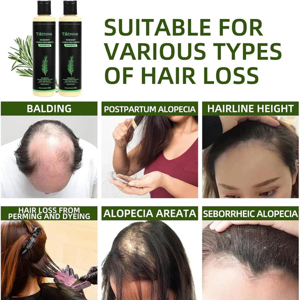 Tiktrove Rosemary Shampoo - Image 3