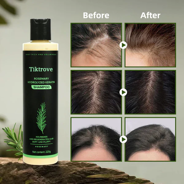 Tiktrove Rosemary Shampoo - Image 5