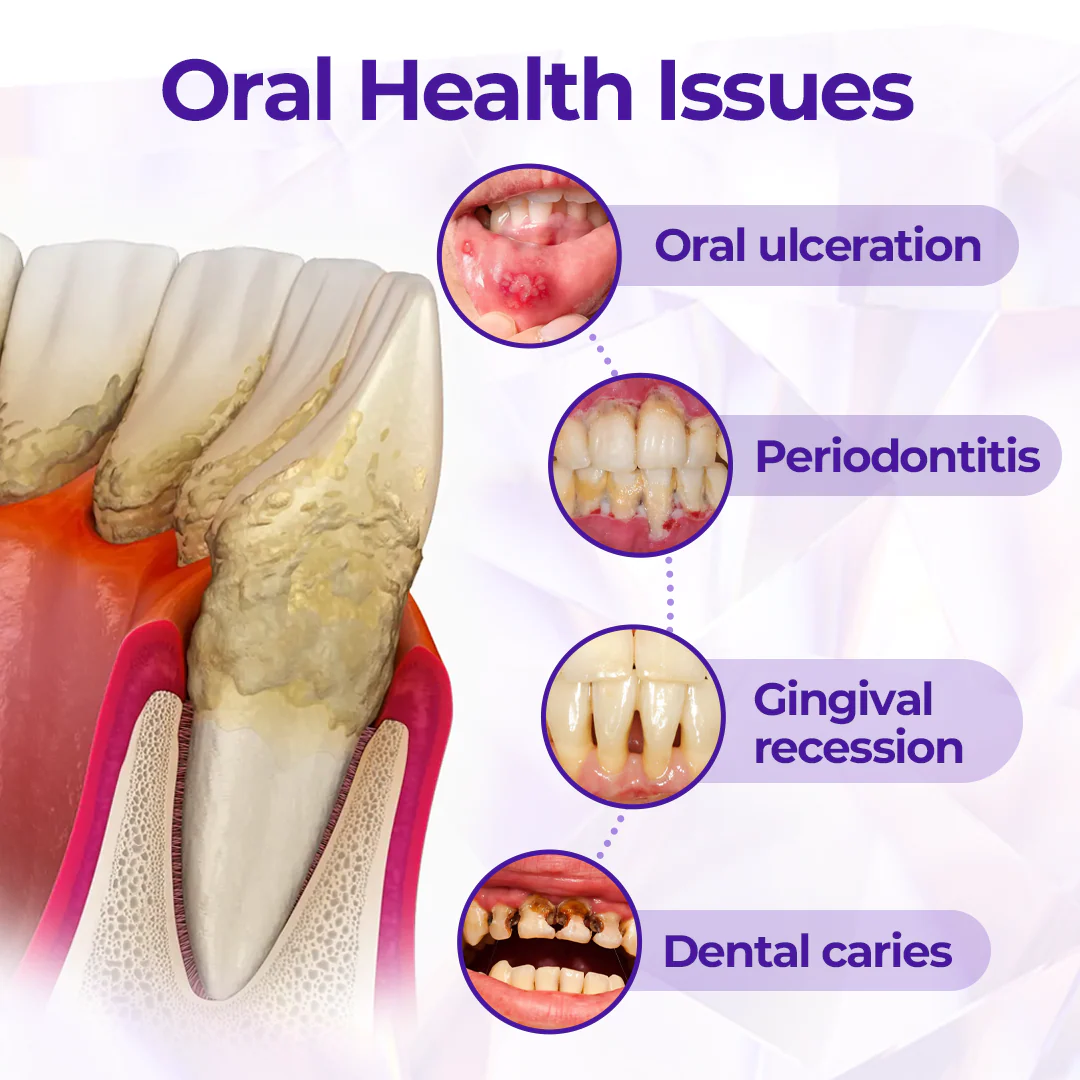 SensiGum Fluoride Toothpaste - Image 11