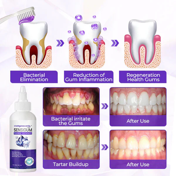 SensiGum Fluoride Toothpaste - Image 8