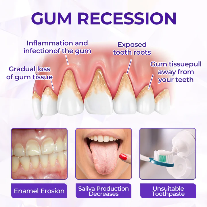 SensiGum Fluoride Toothpaste - Image 9