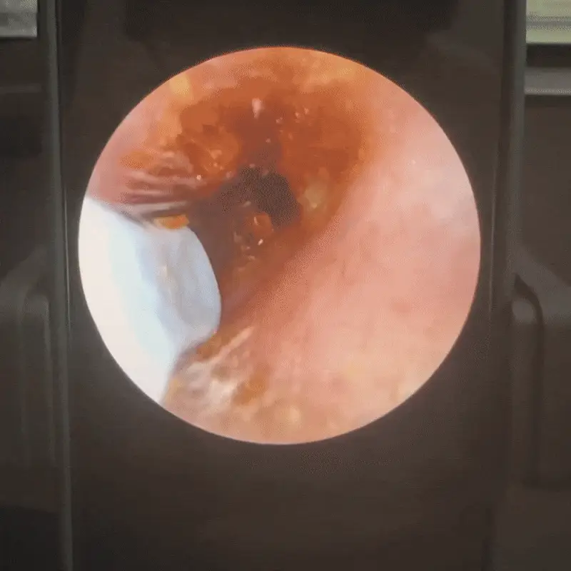 Tiktrove: Doctor Approved Ear Health Technology - Image 2