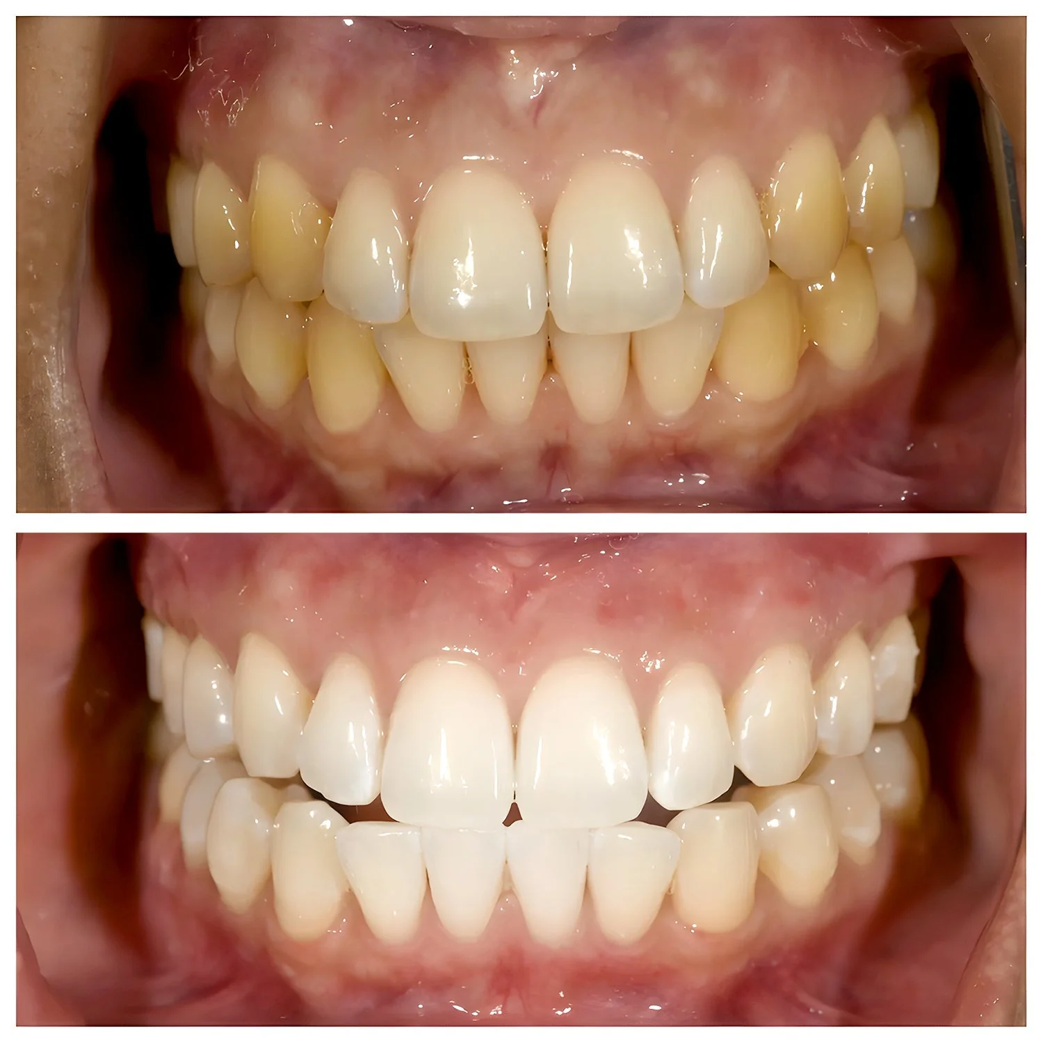 TriBright - ToothPaste - Image 7