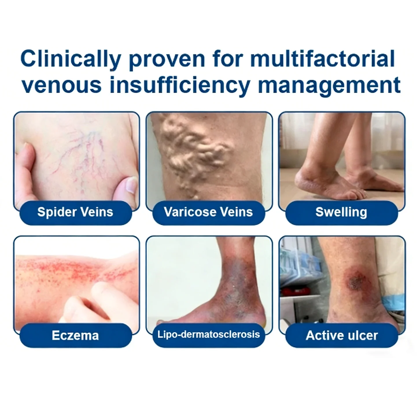 Vein ContourMicroneedle Patch with AdvancedDiosmin & Hesperidin Delivery 🌿 7-Day Visible Results for VaricoseVeins - Image 3