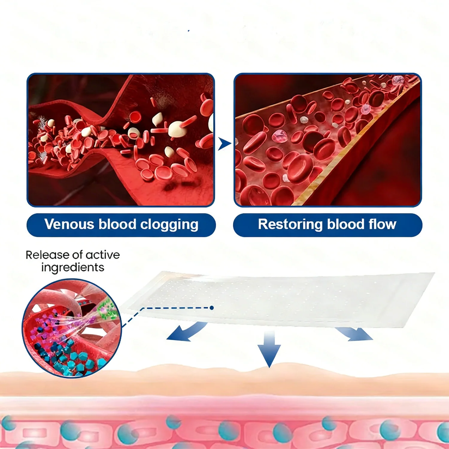 Vein ContourMicroneedle Patch with AdvancedDiosmin & Hesperidin Delivery 🌿 7-Day Visible Results for VaricoseVeins - Image 9