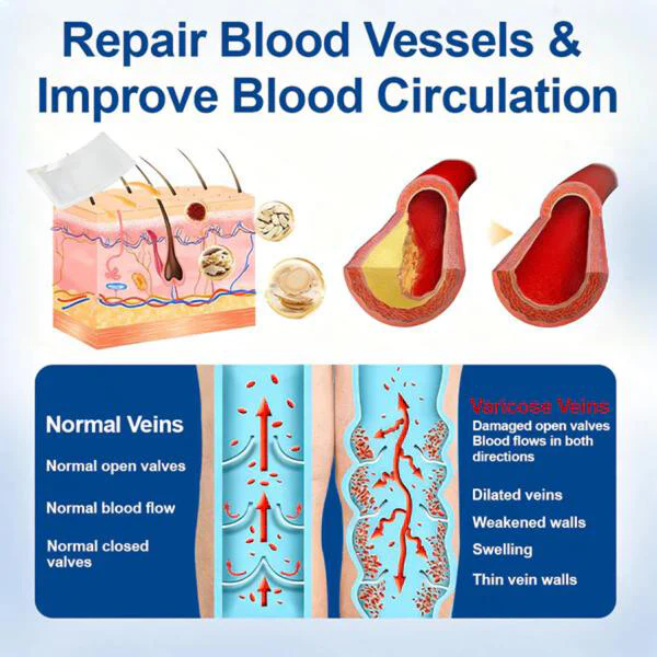 👨‍⚕️✅✅VeinTarget Microneedle Patch⚡Instant Relief, Long-Term Results - Image 7