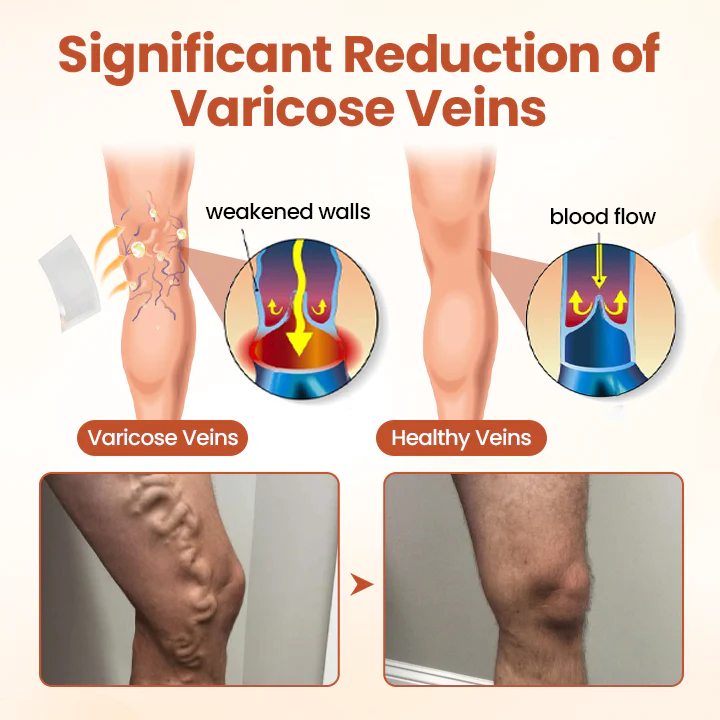 VeinTarget Microneedle Patch - Image 3